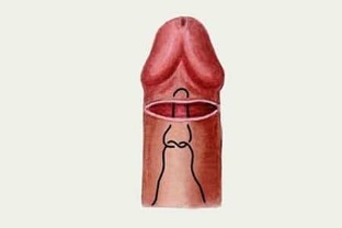 како да се зголеми пенисот